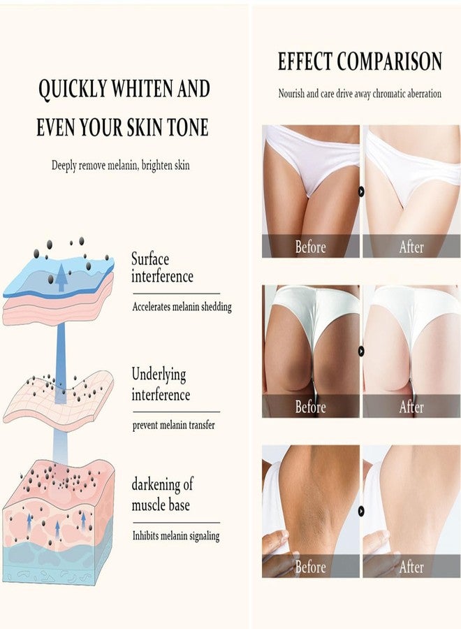 Go Ho كريم تبييض البشرة بالثلج، كريم تفتيح البشرة بفيتامين C للمناطق الحساسة والتبييض، كريم مبيض للمناطق الحساسة، مزيل البقع الداكنة للوجه، الإبط، تحت الإبط، الكوع، الفخذ الداخلي - Image 2