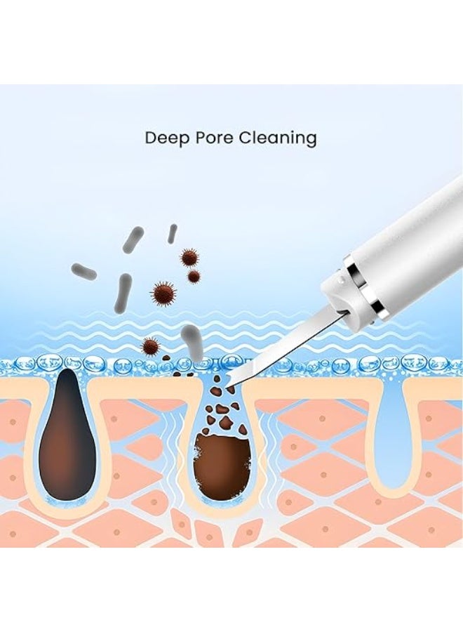 جهاز تنظيف البشرة وإزالة الرؤوس السوداء – منظف عميق للمسام وإزالة الشوائب والدهون للوجه والأنف بسهولة - Image 5