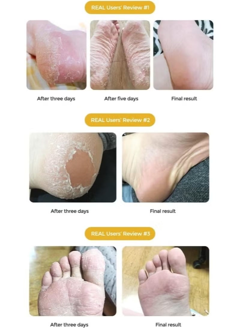 بيور ديرم قناع تقشير القدمين من بيورديرم بوتانيكال تشويس، ، زوج واحد - Image 4