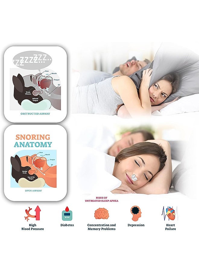 Anti Snoring Device, Adjustable Wind Speed Electric Nasal Soothing Device, Effective Snoring Prevention for Men and Women (White)