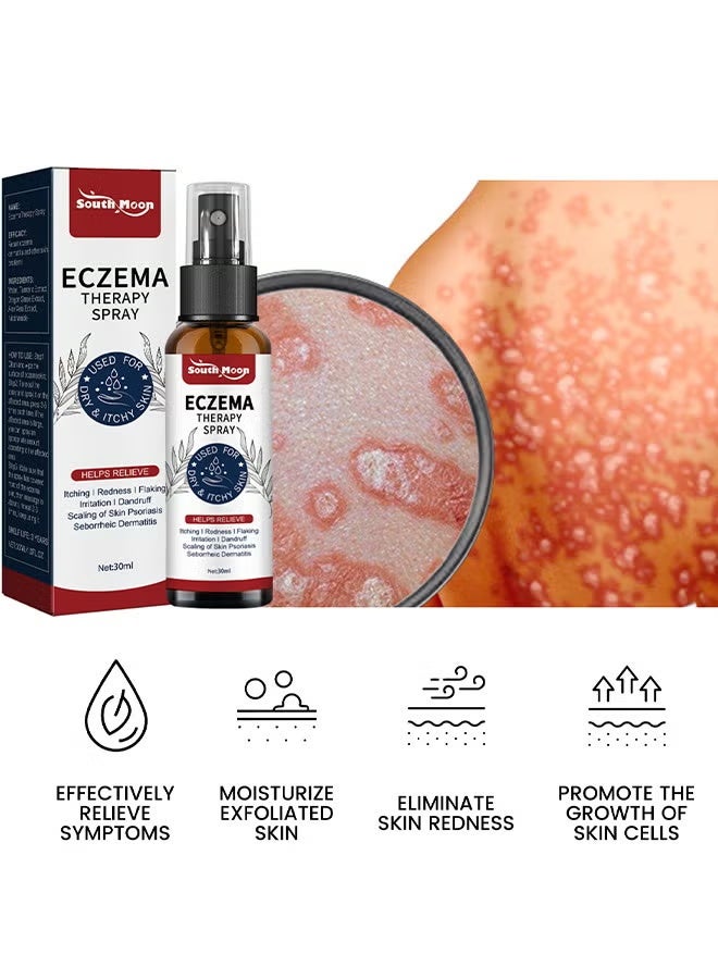 SOUTH MOON Psoriasis Relief Spray 30ML, All Natural Eczema Treatment, Psoriasis Treatment, Fast Relieve Itching And Redness, Skin Care Pain Itch Therapy Spray, Fast Relief Spray For Face And Body - Image 4