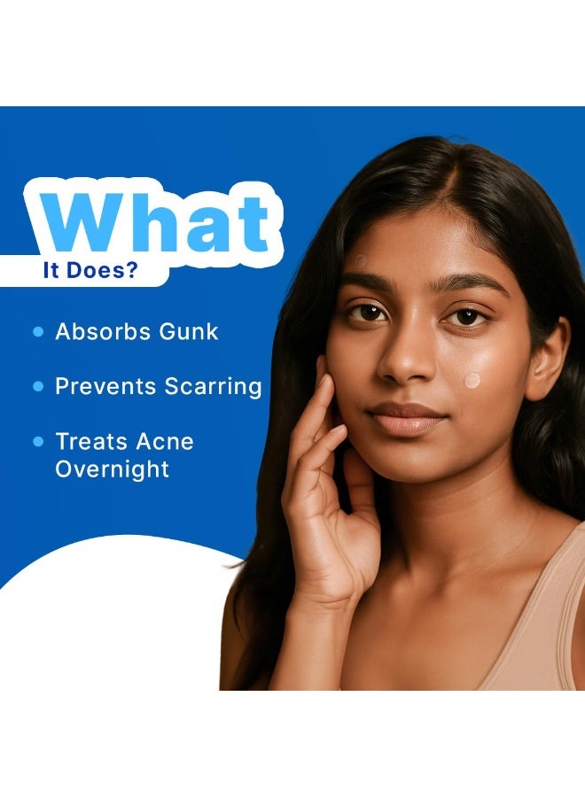 So True Sotrue Acne Pimple Patches For Face | For Active Surface Acne | Hydrocolloid Waterproof Patches | Absorbs Pimple Overnight, Reduces Excess Oil | Suits All Skin Types (36 Patches) - Image 4