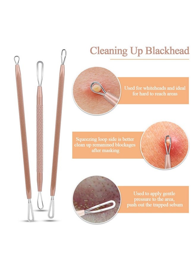 MENOLY - Pimple Popper Tool Kit Menoly 10 Pcs Blackhead Remover Comedone Extractor Acne Removal Kit For Blemish Whitehead Poppingzit Removing For Nose Face Tools With A Leather Bag (Rose Gold) - Image 1