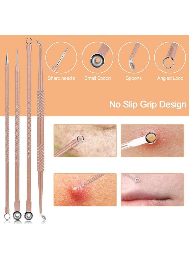 MENOLY - Pimple Popper Tool Kit Menoly 10 Pcs Blackhead Remover Comedone Extractor Acne Removal Kit For Blemish Whitehead Poppingzit Removing For Nose Face Tools With A Leather Bag (Rose Gold) - Image 1