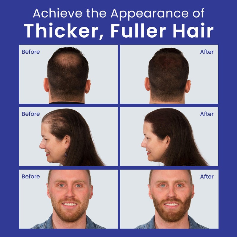 INFINITY Hair Fibers Black for Thinning Hair for Women & Men - 100% Undetectable Hair Building Fiber Powder - Conceal Hair Loss in 15 Seconds, 15g - Image 2