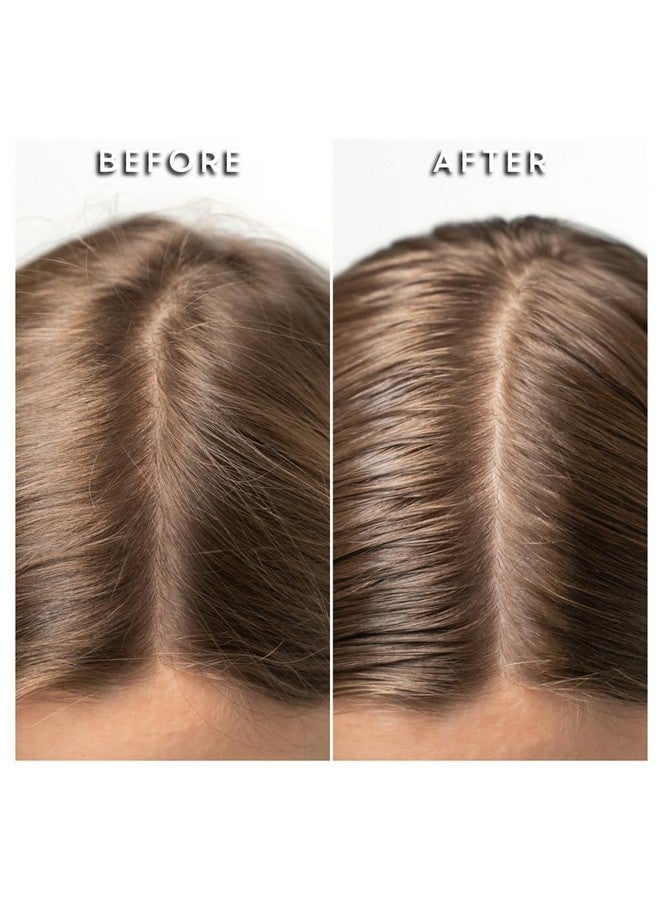 Mudmasky Scalp Serum 60ml/2.0 FL OZ - Vitamin-Infused Hair Serum, Strengthens and Thickens Hair from Root, Repairs Chemical Damage, Anti-Hair Loss, Moisturizes Scalp, Suitable for All Hair Types - Image 3