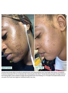 Urban Skin Rx ® Mega Moisture Illuminating Nighttime Face Cream | Combats Signs of Aging, Helps Prevent Dry Skin and Locks In Moisture, Formulated with Vitamin E, Green Tea, & Shea Butter | 1.7 Oz  - Image 4