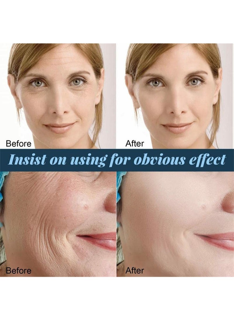 EELHOE - Protein Line Hydrolyzed Collagen,Soluble Protein Thread,Protein Thread Lifting Set,Protein Lifting Threading Set,Absorbable Collagen Thread for Face Lift (2 Box) - Image 1