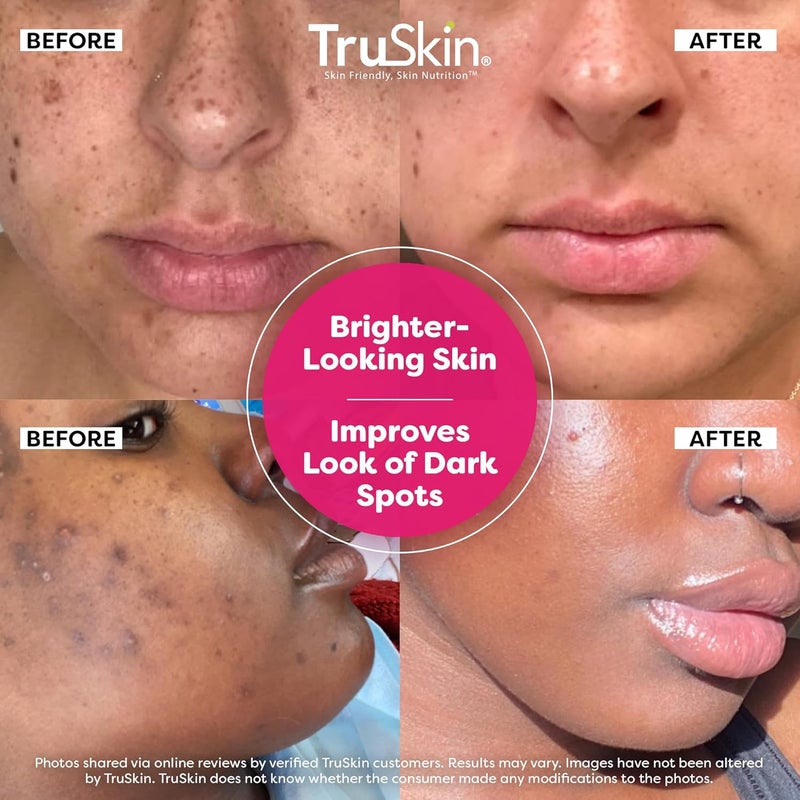 TruSkin Vitamin C Super Serum Niacinamide Retinol Hyaluronic Salicylic Acid AllinOne Anti Aging Serum for Face Improve Appearance of Dark Spots Firmness for Brighter Looking Skin 2 Fl Oz - Image 2