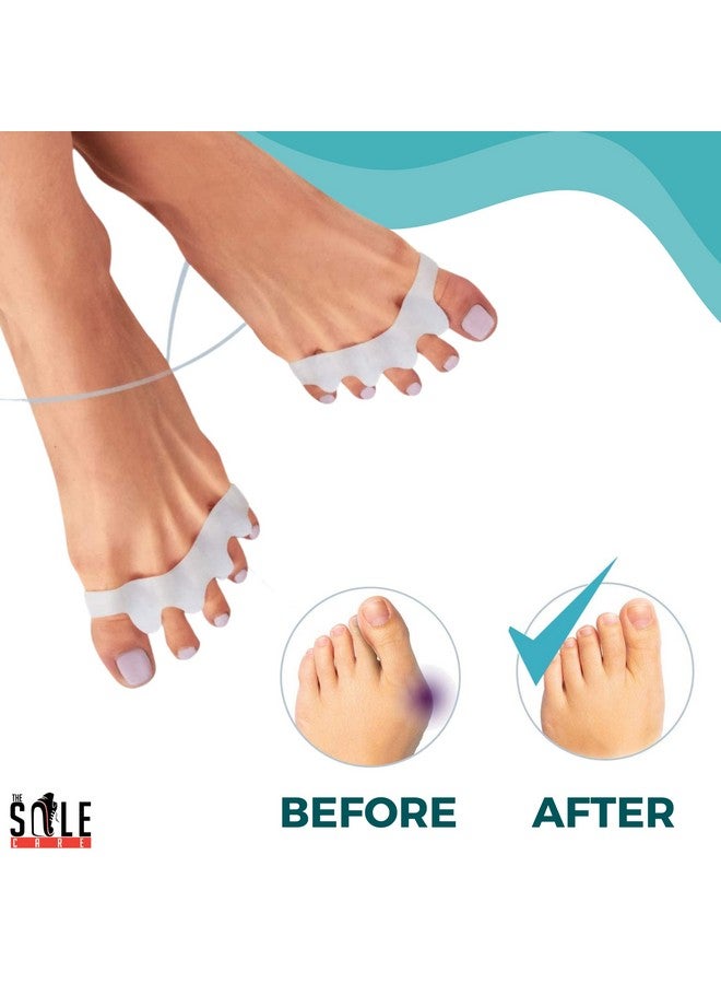 Royalkart The Sole Care® PREMIUM Silicone Toe Seperators; Toe Spacers For Bunions,Crooked Toes,Blisters,Hammer Toes|(Pack Of 1 Pair Of Unisex Toe Correctors)(White),One Size - Image 3
