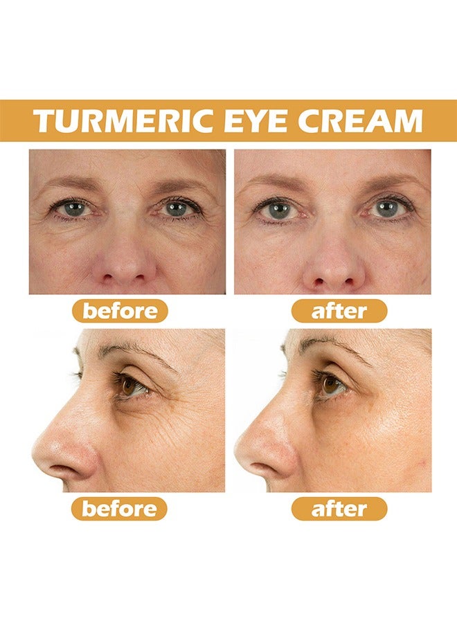 EELHOE Turmeric Eye Cream-24 Hours Vanish Fine Lines，Eye Bags,Dark Circles And Puffiness - Image 5