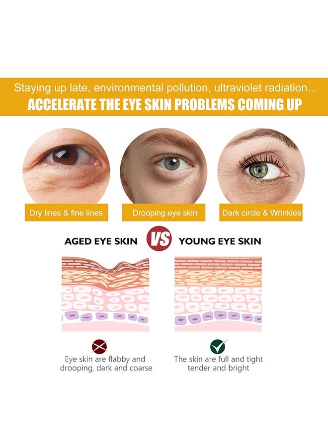 EELHOE Turmeric Eye Cream-24 Hours Vanish Fine Lines，Eye Bags,Dark Circles And Puffiness - Image 2