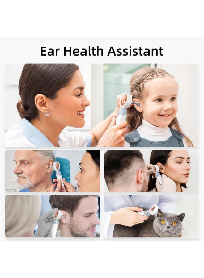 This ear-lens camera features a 1.38-inch digital display, a portable handheld 1080P HD ear-lens with 4 LED lights, suitable for children and adult pets, is rechargeable, comes with soft silicone ear tips, is safe and easy to use, and has built-in storage + SD card support. - Image 2