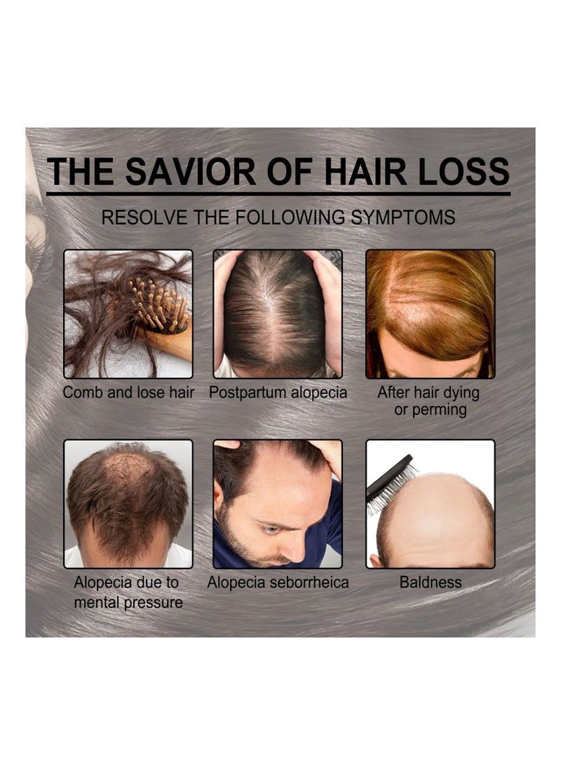 EELHOE 30ml Rosemary Hair Growth Essential Oil Prevent Hair Loss Nourish Scalp Strengthen Hair - Image 5