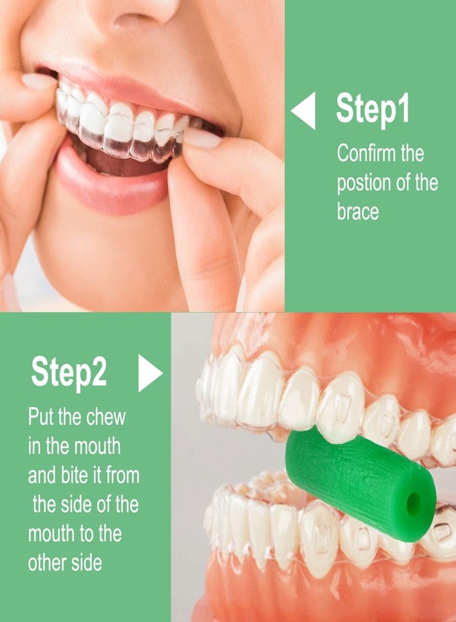 BVN Aligner Chewies, 10 Pieces Orthodontic Chewies, Retainer Chewies, Dental Chewies for Aligners, Orthodontic Dental Chewies Munchies, Green - Image 3