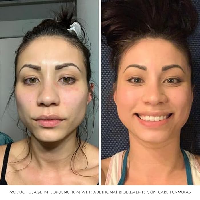 Bioelements Flash Foam Cleanser - 6.5 fl oz - Exfoliating Foam Cleanser for Oily, Combination & Dry Skin - Vegan, Gluten Free - Image 5