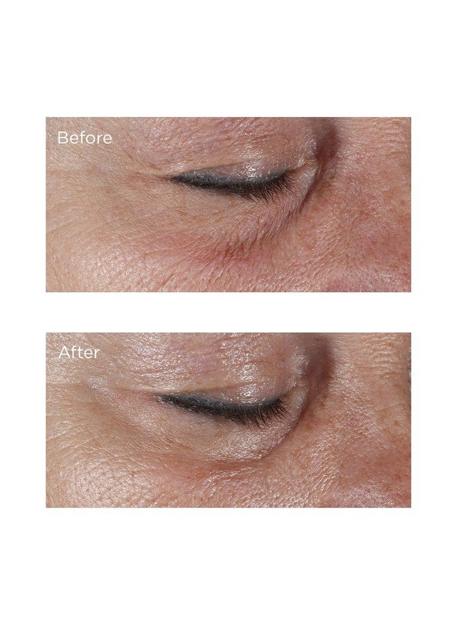 Perricone MD Hypoallergenic Firming Eye Cream, 0.5 fl. oz. - Image 4