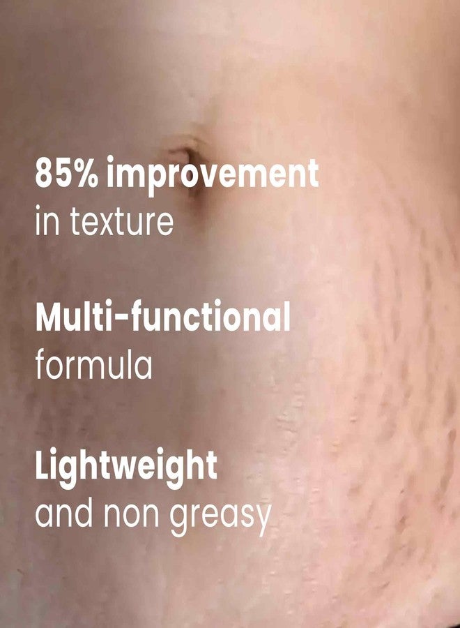 Saffr'n Anti Stretch Marks Oil with Saffron extract to Prevent Stretch Marks | 30 ml - Image 2