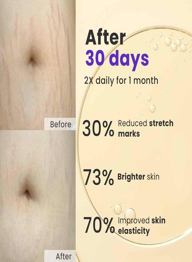 Saffr'n Anti Stretch Marks Oil with Saffron extract to Prevent Stretch Marks | 30 ml - Image 3