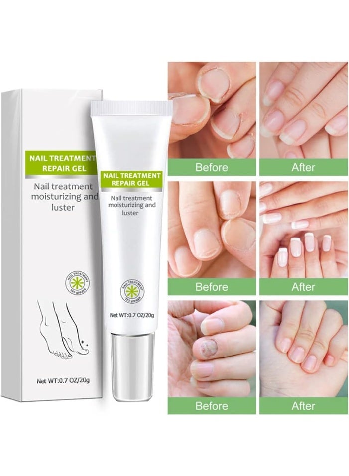 DubaiGallery Nail Repair Cream Gray Nail Repair Cream, Onychomycosis Nail Cream, Nail Gel, Toenail Repair Ointment Sywqhk Beauty Care - Image 2