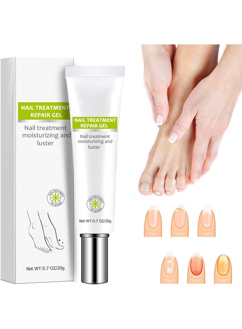 DubaiGallery Nail Repair Cream Gray Nail Repair Cream, Onychomycosis Nail Cream, Nail Gel, Toenail Repair Ointment Sywqhk Beauty Care - Image 1