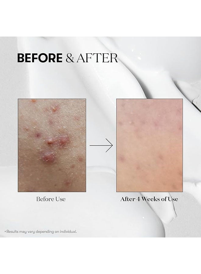 في تي كوزمتيكس سيكا ريدل شوت 100 جوهر ، تنطبق على البشرة ناعمة الوجه يوميا جوهر ، اسيا تيكوسا مجمع ، حمض الهيالورونيك ، تنطبق على جميع الجلد الأخضر دنج استخراج 50 مل - Image 4