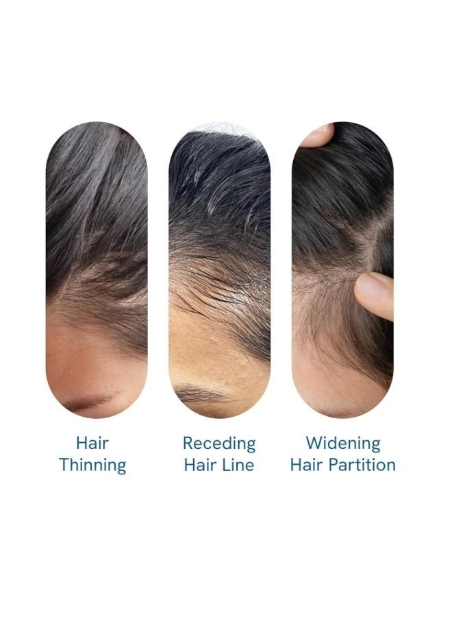 Bodywise 3% Redensyl & Rosemary Hair Growth Serum (Roll On) | Pack of 1 | 2% Anagain | Thicker & Stronger Hair | Prevents Hairfall & Stimulates Hair Follicles | for All Hair Types | 25 Ml - Image 3