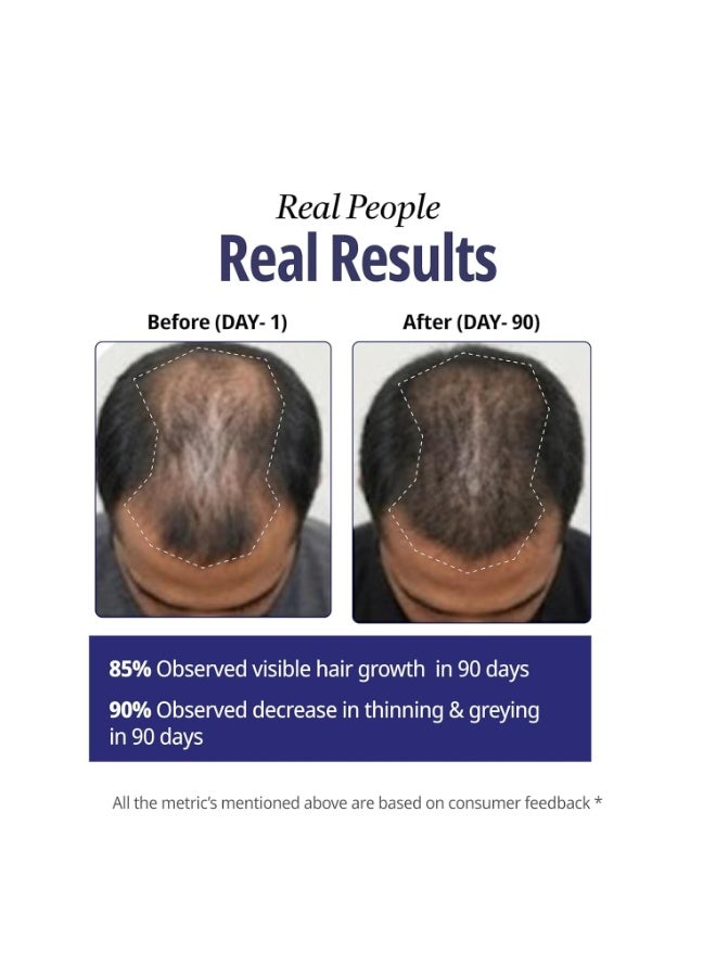Reginald Men Athena- All in one Hair Serum | Hair Fall Control & Follicle Boost with 12 Actives | Advanced Hair Growth Serum For Scalp | Controls HairFall & Boosts New Hair Growth | For Men | 30ml - Image 2