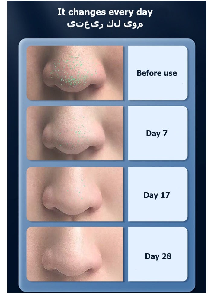 Ultrasonic Vibrate  Remove Dirt Blackhead  Deep Face Cleaning Skin ScrubberReduce Wrinkles Facial Lifting Peeling Ultrasonic Shovel