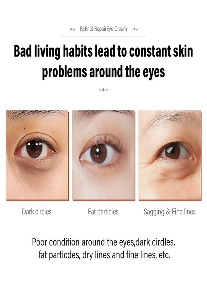 Grospe 2 Pcs Retinol Repair Eye Cream，Instant Results Eye Cream，Reduces the Appearance of Dark Circles，Stretch Wrinkles at the Corners of the Eyes，Moisturize and Improve Eye Bags，1.05 Oz Each - Image 5