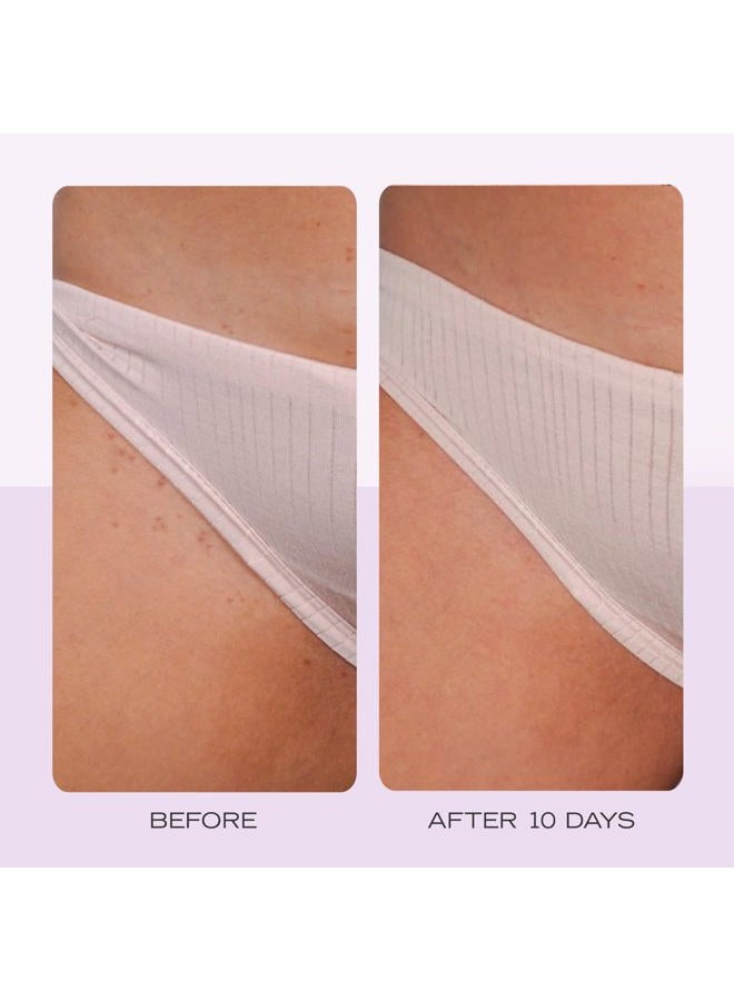 First Aid Beauty وسادات الشعر الناشئ مع BHA + AHA - وسادات علاج ما بعد الحلاقة للمساعدة في منع نتوءات الحلاقة للرجال والنساء - تقشير الإبطين ومنطقة البيكيني - قابلة للتحلل للاستخدام اليومي - 28 وسادة - Image 5