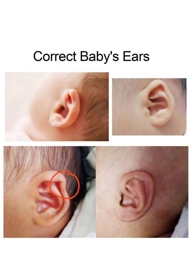 Baby Auricle Valgus Correction Patch Silicone Newborn Baby Ear Aesthetic Correctors Kids Infant Protruding Ear Patch Stickers for Newborn Infant Correction Health Care - Image 2