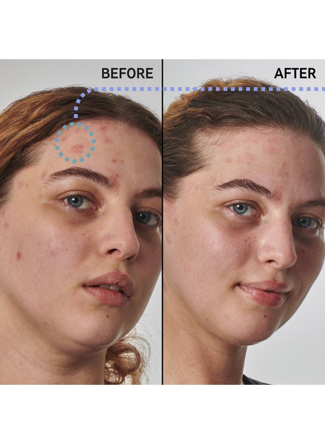 مرطب إنكي ليست سوبر سوليوشنز® بتركيز 10% من اليوريا - Image 4