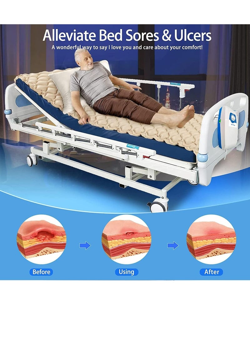 Silent Alternating Air Pressure Mattress With Mattress Cover And Pump Inflatable Adjustable Silent Mattress To Prevent Bedsores And Soreness And Treat Bedridden Patients - Image 3