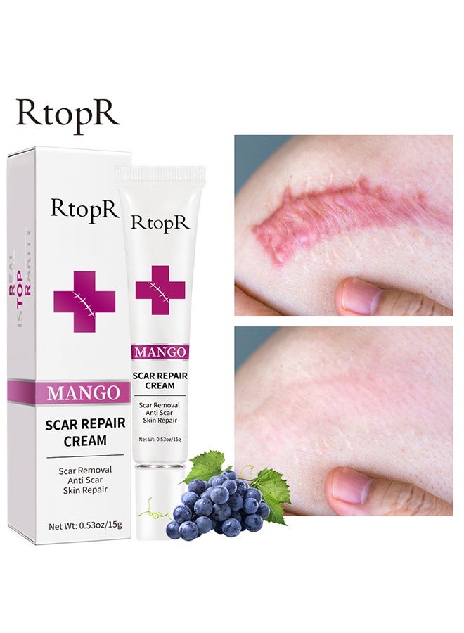 آر توب آر إزالة ندبة المانجو كريم ندبة علاج إصلاح الجلد علامات التمدد حب الشباب الرعاية الجراحية 15G - Image 1