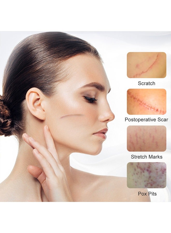 آر توب آر إزالة ندبة المانجو كريم ندبة علاج إصلاح الجلد علامات التمدد حب الشباب الرعاية الجراحية 15G - Image 4