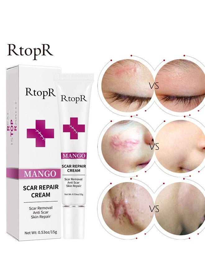 آر توب آر إزالة ندبة المانجو كريم ندبة علاج إصلاح الجلد علامات التمدد حب الشباب الرعاية الجراحية 15G - Image 2