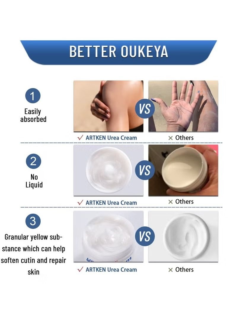  آتكن 150 جرام 40% كريم اليوريا حمض الصفصاف كريم القدم صدع اليد جرب مزيل كريم اليد القدم صدع الكعب العالي الكعب الكوع الأظافر الركبتين ترطيب الجلد أقصى قوة محلول اليوريا - Image 3