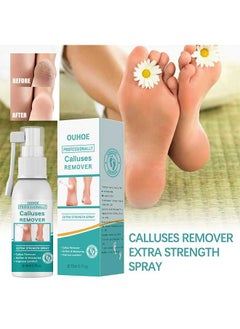 OUHOE Calluses Remover Extra Strength Spray 20ml, Anti Cracking Heel Of Foot, Cleaning Dead Cutin, Moisturizing Foot Spray, Cocoon Repair Spray  - Image 1
