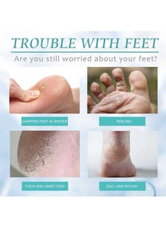 OUHOE Calluses Remover Extra Strength Spray 20ml, Anti Cracking Heel Of Foot, Cleaning Dead Cutin, Moisturizing Foot Spray, Cocoon Repair Spray  - Image 3