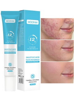 MOOYAM Salicylic Acid Remove Acne Gel 20G, Rapid Action Acne Spot Treatment for Face Closure And Acne Dots, Premium Acne Scar Gel And Pimple Remover  - Image 1
