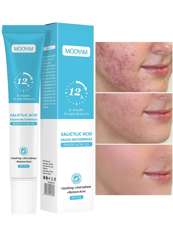 MOOYAM Salicylic Acid Remove Acne Gel 20G, Rapid Action Acne Spot Treatment for Face Closure And Acne Dots, Premium Acne Scar Gel And Pimple Remover  - Image 1