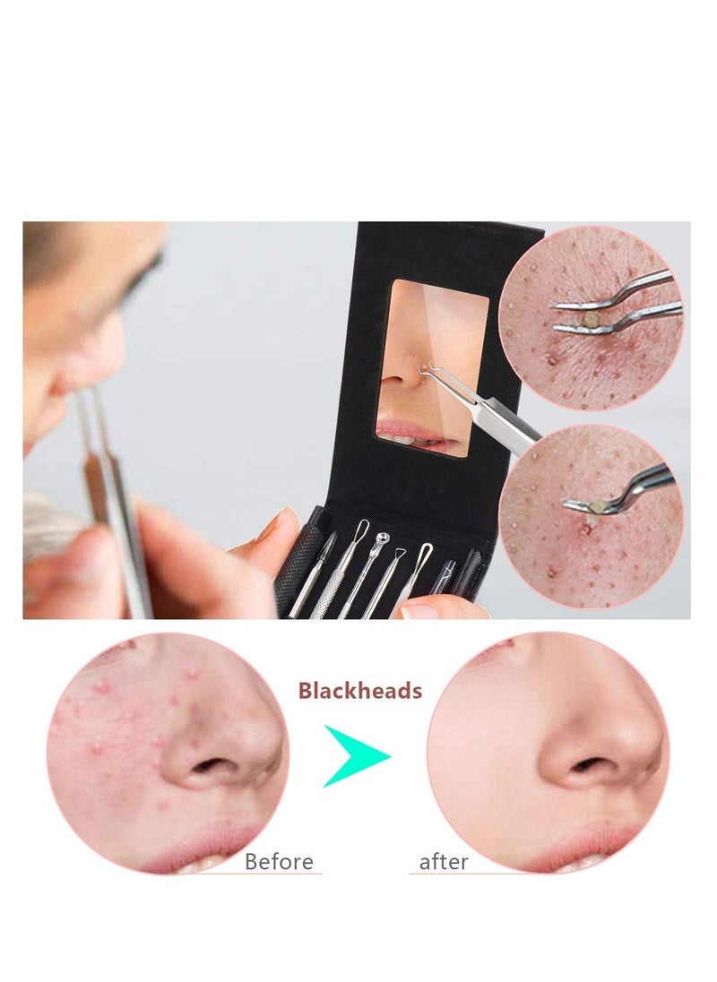 SYOSI Pimple Popper Tool Kit Stocking Stuffers Blackhead Remover Kit 6 Pcs Ingrown Hair Removal Kit White Heads Removers Pore Extraction Tool Facial Skin Acne Zit Tools  - Image 2