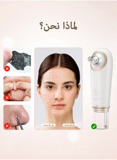 KinseiBeauty Blackhead Remover Vacuum Facial Pore Cleaner Electric Acne Comedone Extraction Whitehead Blackhead Tool  - Image 5