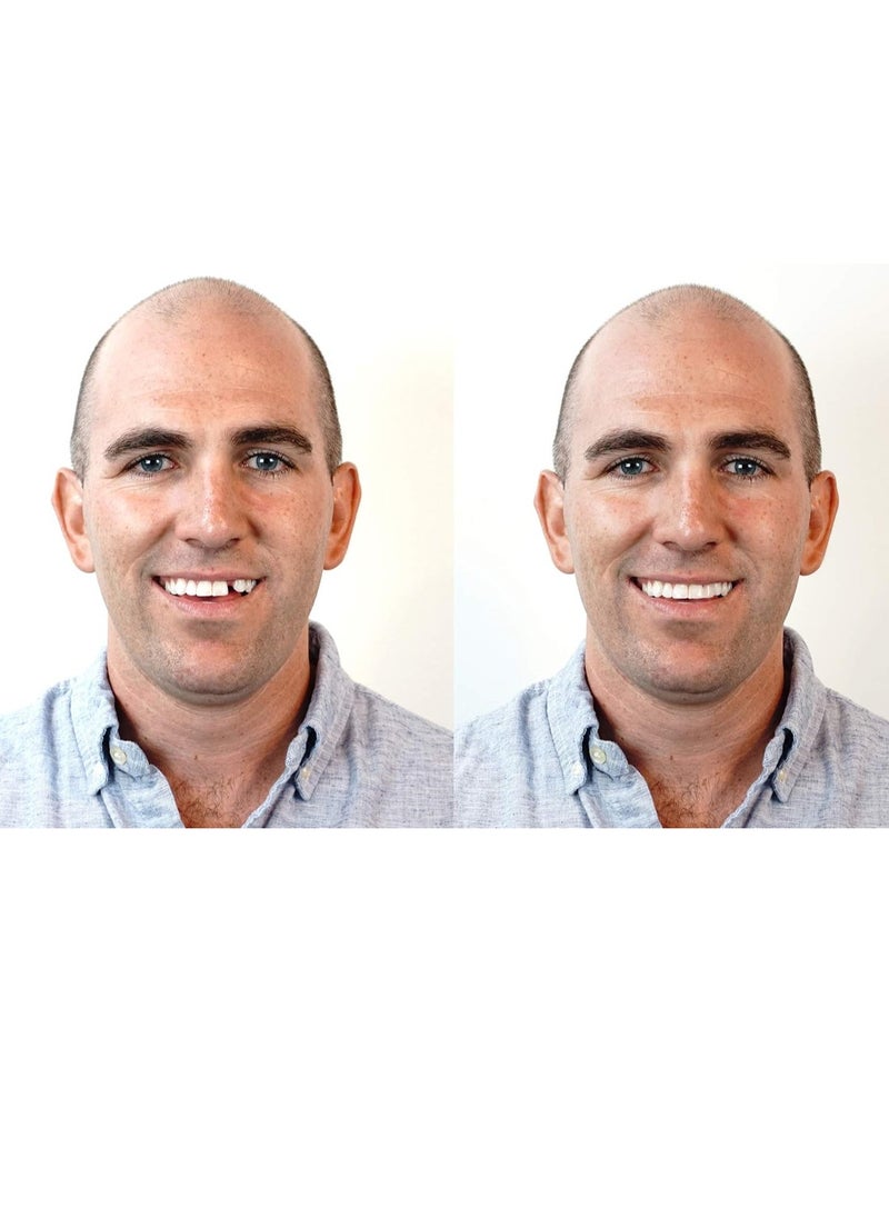 Instant Smile Instant Smile Triple Shade Temporary Tooth Kit - Replace A Missing Tooth in Just 5 Minutes!  - Image 2