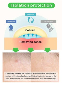 Breylee 22 Patches Acne Pimple Patch, Acne Healing Blemish Spot Treatmentmade with Tea Tree, Diminishinflammation, Adjustgrease Secretion, Relieveskin and Acceleratewound Healing for Evening Use  - Image 4
