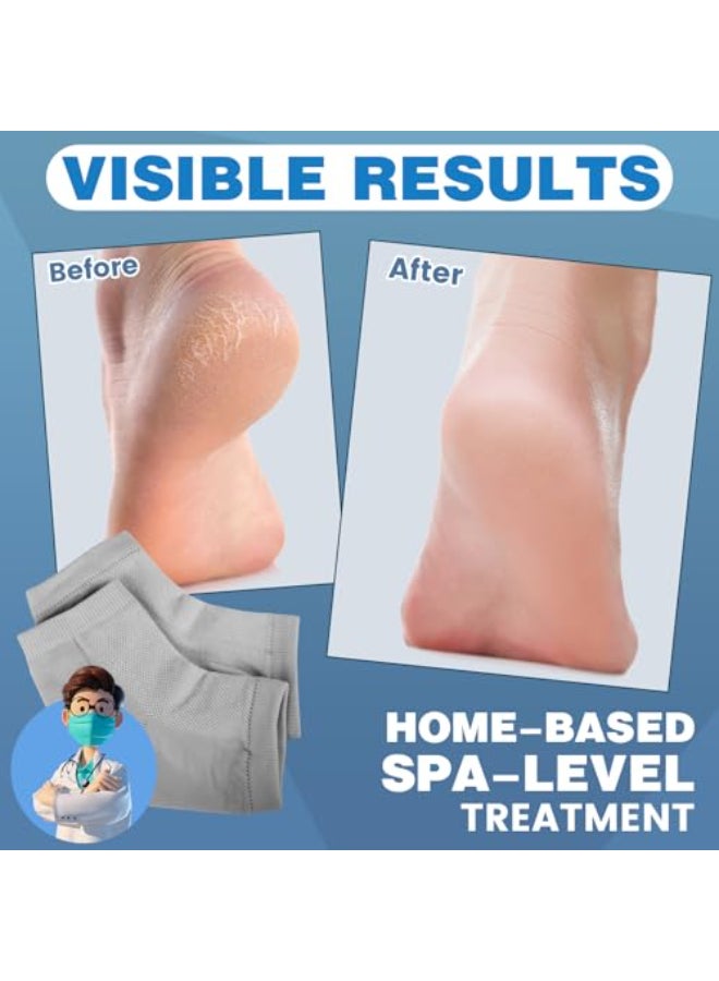 TEAWOO 3 Pairs Moisturizing Heel Socks for Cracked Heel Treatment Foot Care Toeless Socks to Soften and Hydrate Dry Cracked Feet Heels Cracked Heel Repair Socks Gel Socks for Dry Cracked Feet - Image 3