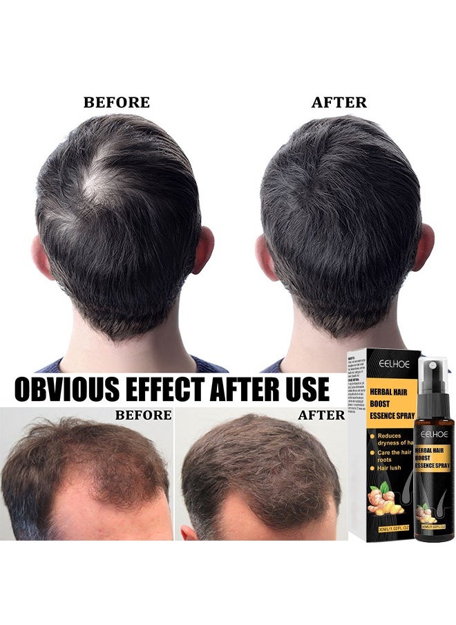 EELHOE - Herbal Hair Boost Essence Spray, Natural Herbal Hair Regrowth Treatment Anti Hair Loss Serum Hair Growth Essence Spray Micro Needling Roller Set, Make Hair Stronger Thicker Longer, 30ML - Image 1