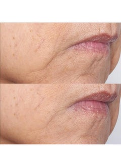 Perricone MD Cold Plasma Plus+ The Intensive Gel Mask Ultrahydrating & Cooling Improves Uneven Texture Wrinkles Loss Of Radiance & Firmness. Leaves Skin Instantly Hydrated Soft & Supple  - Image 4