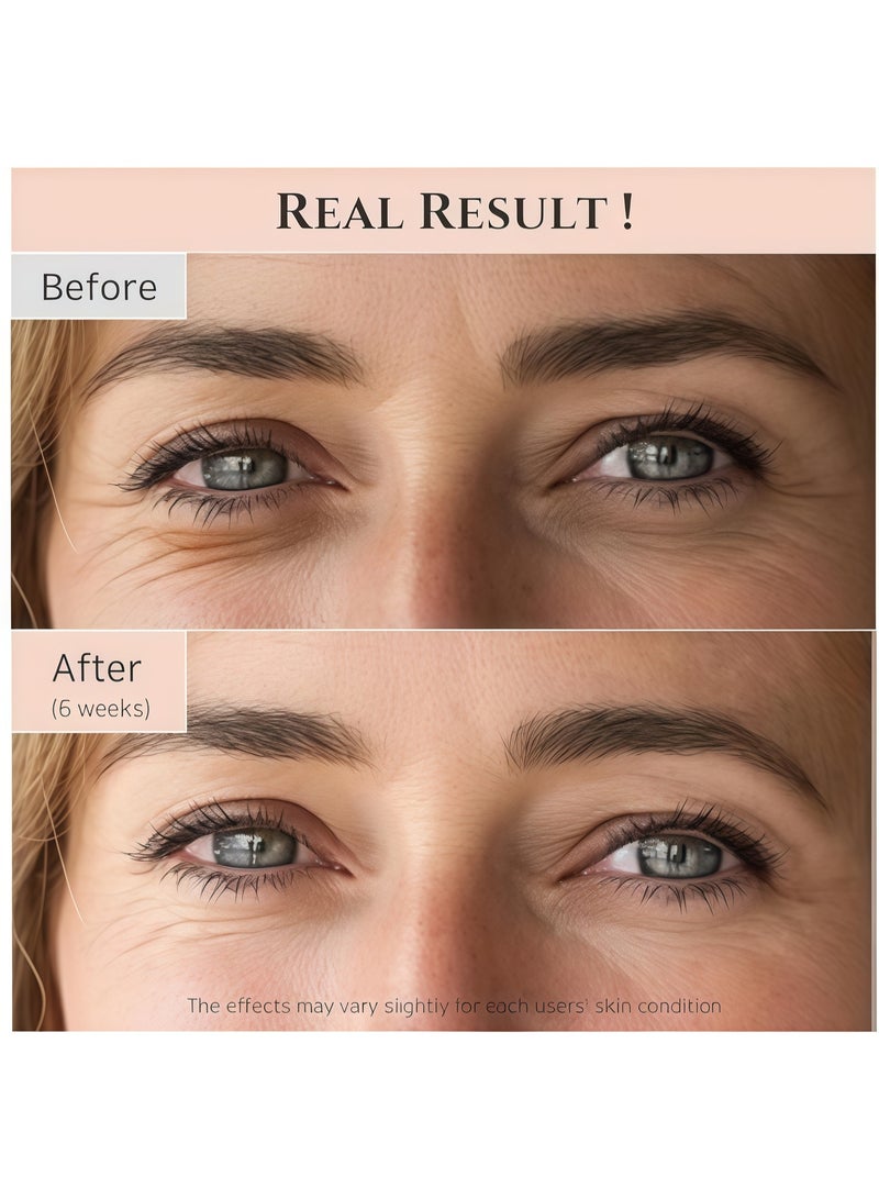 Beauty Bar Revive Eye Serum with Retinal Niacinamide Peptide Correction for Puffy Eye Bags Fine Lines Dark Circles Wrinkles, Korean Skin Care 30ml, 1 fl.oz 30ml  - Image 3